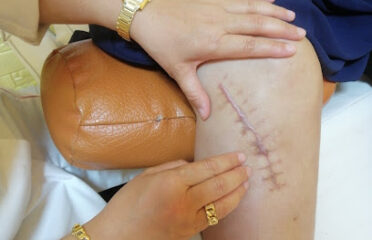 Cabinet kinésithérapie -ostéopathie hijama Batoula boukamous Nador