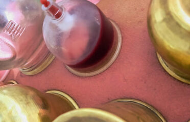 Centre Bouzid pour hijama de la Ventousothérapie