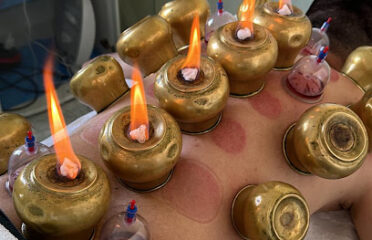 centre de hijama el Baraka Agadir