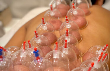Centre Heal & Smile (hijama)