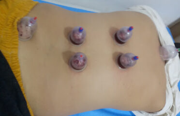 Centre hijama a Marrakech
