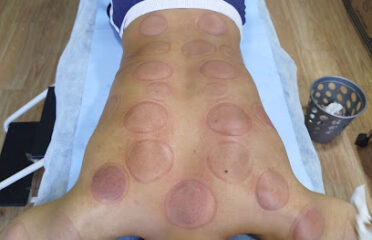 Centre hijama thérapie