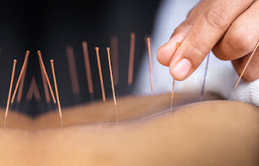 Centre Nasser: kinésithérapie, ostéopathie, Chiropraxie, acupuncture, Posturologie, cupping Therapy