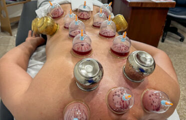 Cupping therapy-Thérapie par hijama
