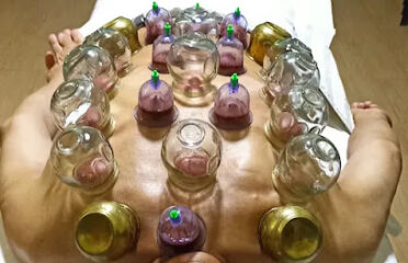 Hijama abu Yuwairia