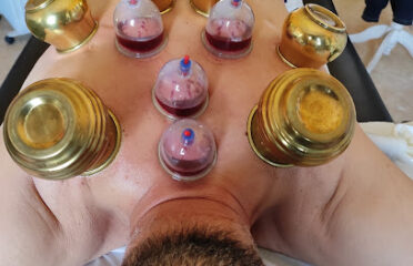 Hijama oujda.