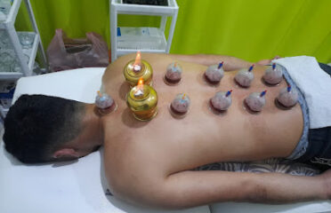 Markaz 3bd Alnwr Lil Hijama