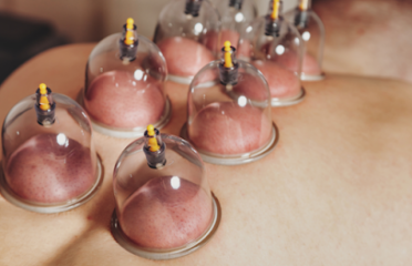 Markaz Bn Almamwn Lil Hijama At Tibbiya Wal3lajat At Tabi3iya