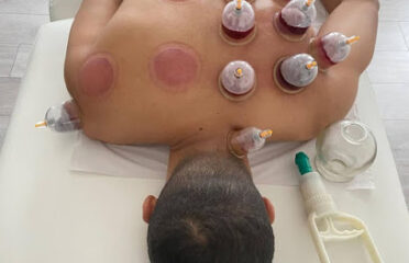 Markaz Slym Lil Hijama Waltb As Sini